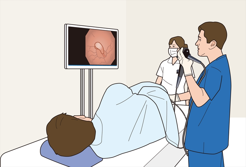 内視鏡検査 胃カメラ 大腸カメラ について 尾道 松本内科胃腸科医院